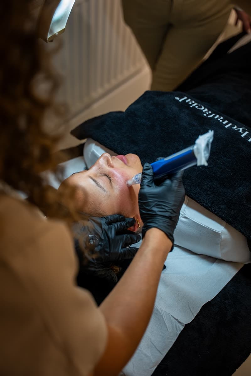 A practitioner carrying out a Hydrafacial treatment in a working clinic